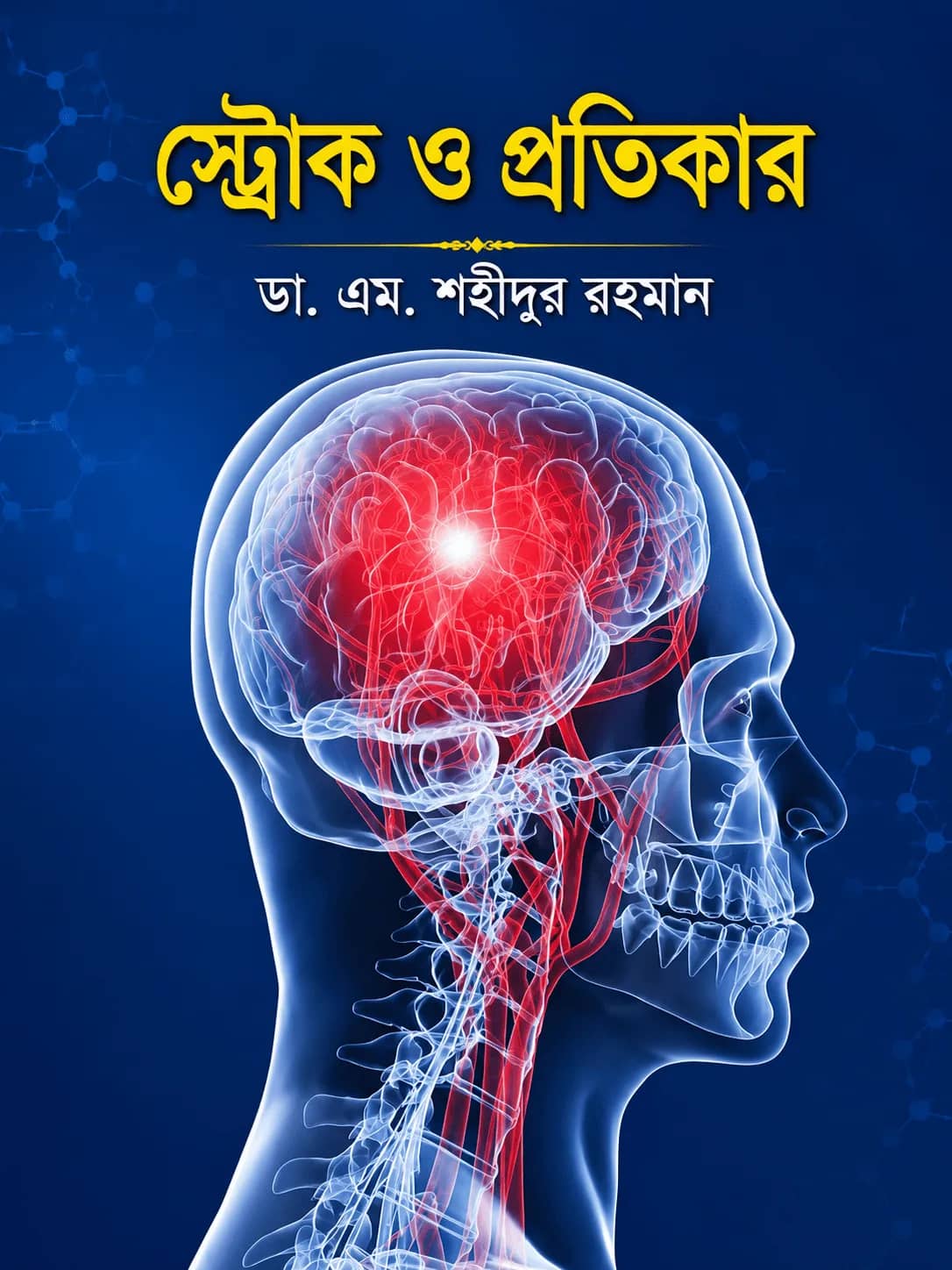 স্ট্রোক ও প্রতিকার