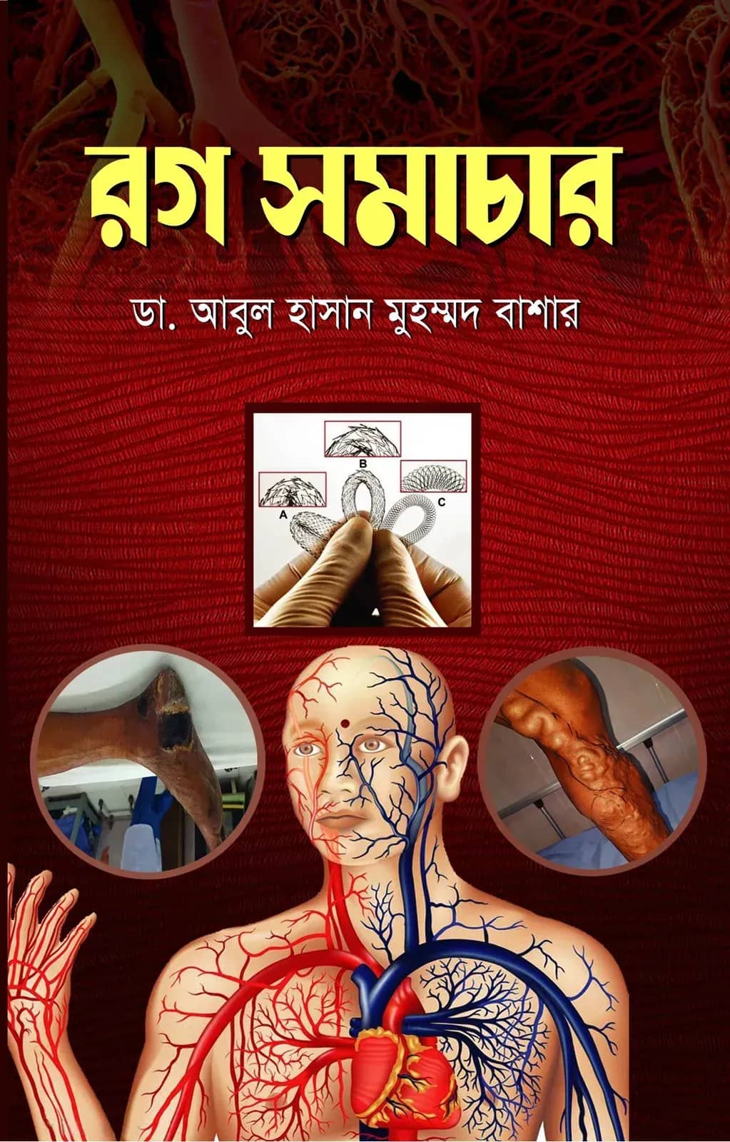 রগ সমাচার