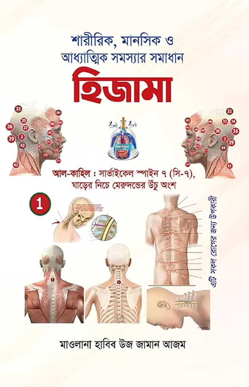 হিজামা