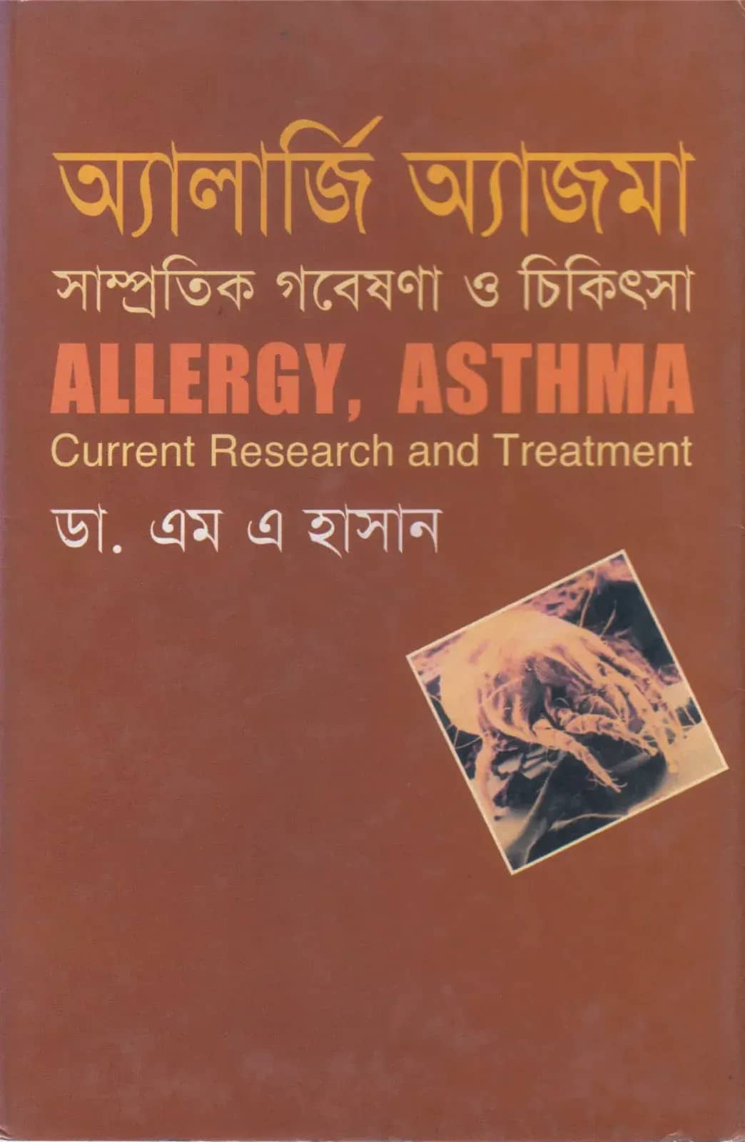 অ্যালার্জি অ্যাজমা
